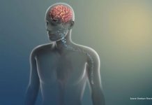 FDA approves first buprenorphine implant for opioid use disorder FDA approves first buprenorphine implant opioid use disorder