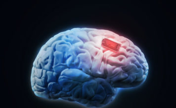 Neuromodulation, a weapon in the fight against opioid addiction neuromodulation opioid treatment