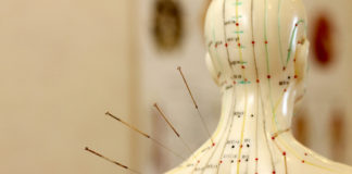Acupuncture may help ease psychological symptoms of opioid addiction acupuncture and opioid addiction