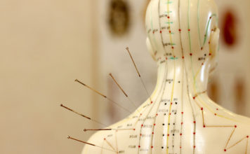 Acupuncture may help ease psychological symptoms of opioid addiction acupuncture and opioid addiction