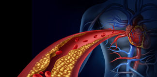 The link between cocaine addiction and vascular disease The link between cocaine addiction and vascular disease