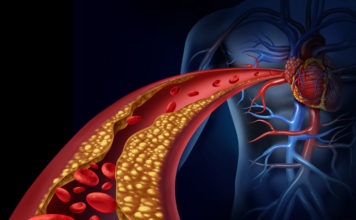 The link between cocaine addiction and vascular disease The link between cocaine addiction and vascular disease