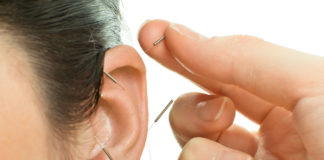 Addiction Recovery in Circleville Supplemented With Acupuncture Treatment Addiction Recovery in Circleville Supplemented With Acupuncture Treatment