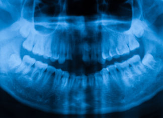 Addiction Has Teeth