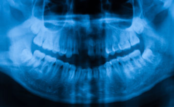 Addiction Has Teeth