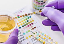 Can You Fail a Drug Test Due to CBD? Will CBD show on a drug test