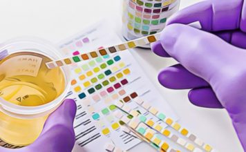 Can You Fail a Drug Test Due to CBD? Will CBD show on a drug test