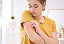 Alcohol Allergy:  Alcohol Intolerance and Allergy Symptoms alcohol withdrawal