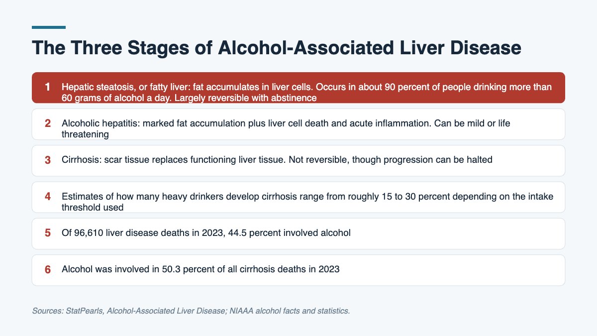 Graphic showing the three stages of alcohol associated liver disease from fatty liver through hepatitis to cirrhosis.