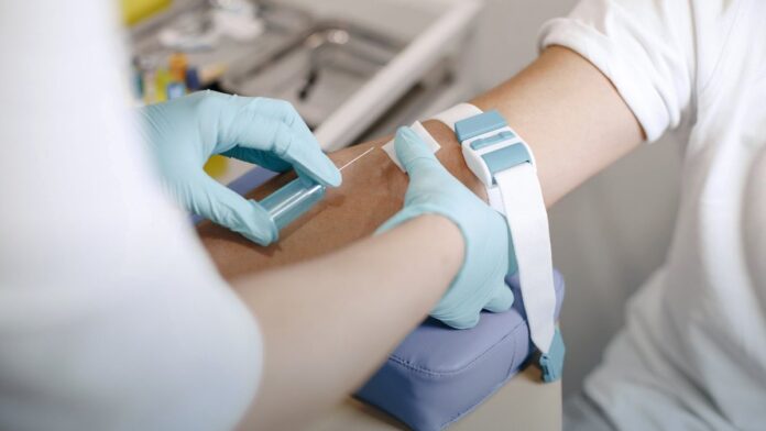 A gloved hand holding a labeled specimen sample in a laboratory. A gloved hand holding a labeled specimen sample in a laboratory.