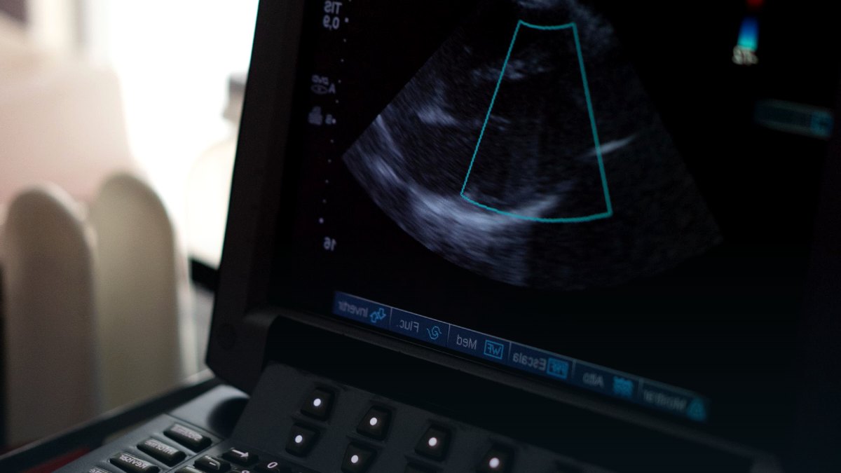 Clinical monitoring equipment displaying vital sign readings.